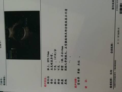 journal_insert_pic_577498569