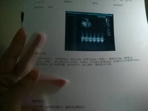 journal_insert_pic_578186690