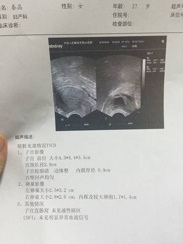 journal_insert_pic_578934311