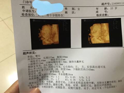 journal_insert_pic_579315259