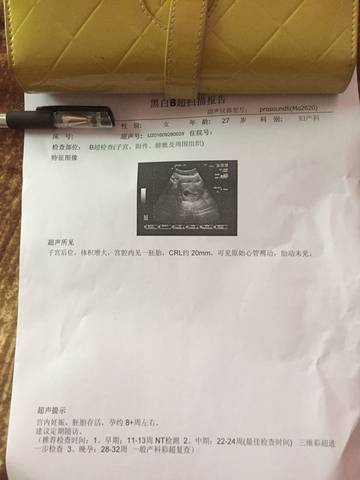 journal_insert_pic_579234468