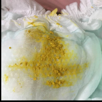 您好,请问这婴儿便便颜色正常吗?