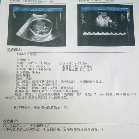 journal_insert_pic_579272708