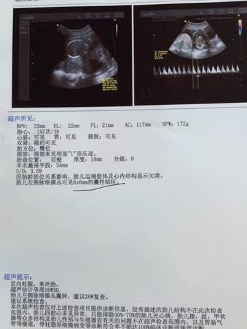 journal_insert_pic_579459702