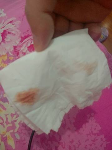 孕5周,有咖啡色分泌物,怎么办?_宝宝树 孕5周,有咖啡色分泌物,怎么办?_宝宝树