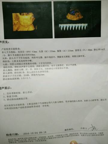 journal_insert_pic_582845984