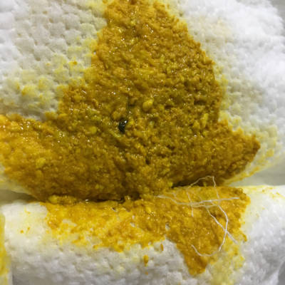 宝宝出生13天纯母乳餵养,今天开始便里出现这样小的黑色团块,不知道要