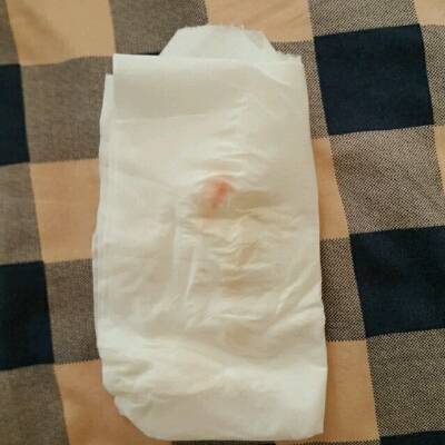 没有任何疼痛感.就是下体宫颈口有点胀.