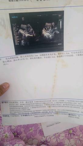 journal_insert_pic_583572275