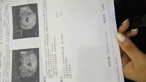 journal_insert_pic_584502916