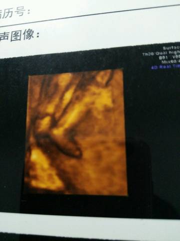 journal_insert_pic_584691257