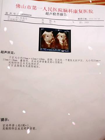 journal_insert_pic_585719804