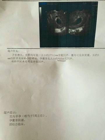 journal_insert_pic_586153050