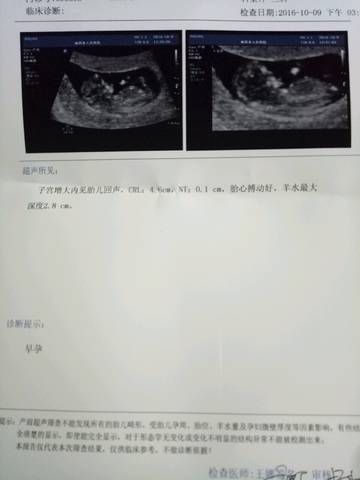 journal_insert_pic_587499662
