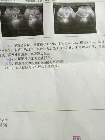 journal_insert_pic_587046708