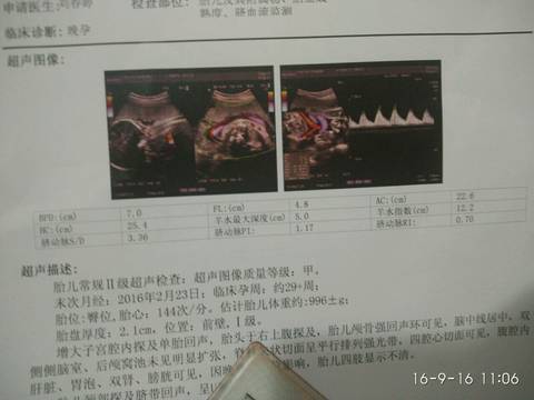 journal_insert_pic_587058166