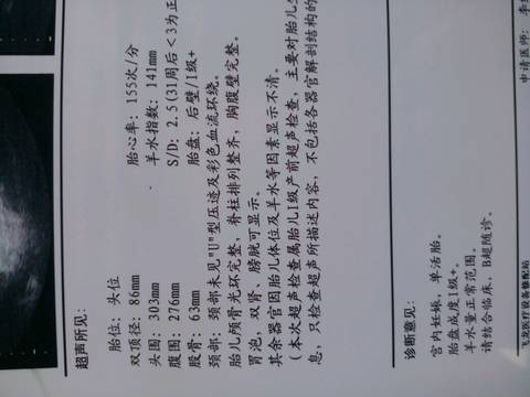 journal_insert_pic_587748574