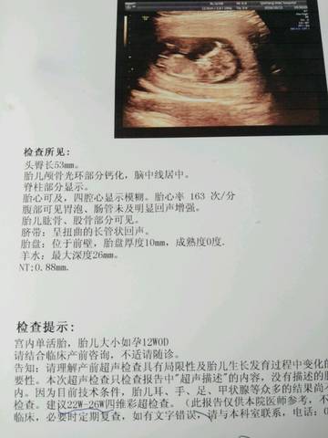 journal_insert_pic_589569457