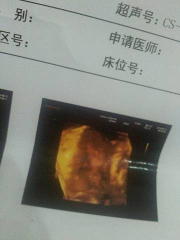 journal_insert_pic_590575511