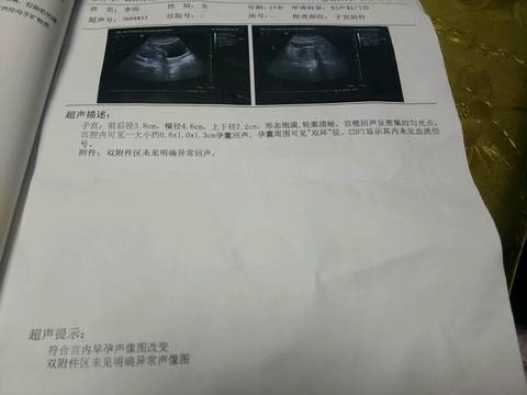 journal_insert_pic_590616290