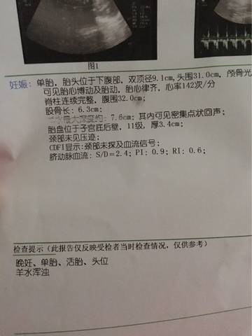 journal_insert_pic_590818417