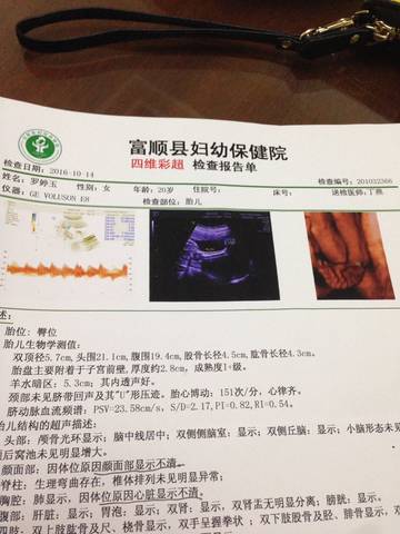 journal_insert_pic_590940657