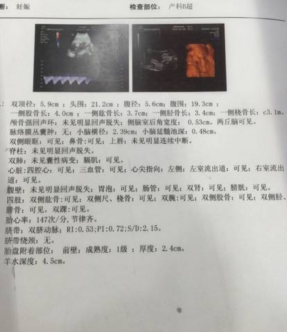 journal_insert_pic_590749369