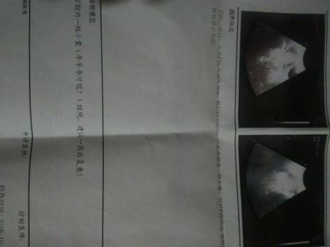 journal_insert_pic_591785710