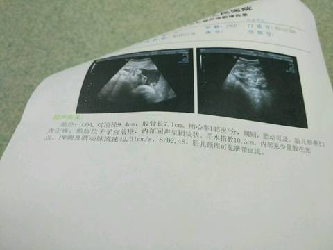 journal_insert_pic_591683054