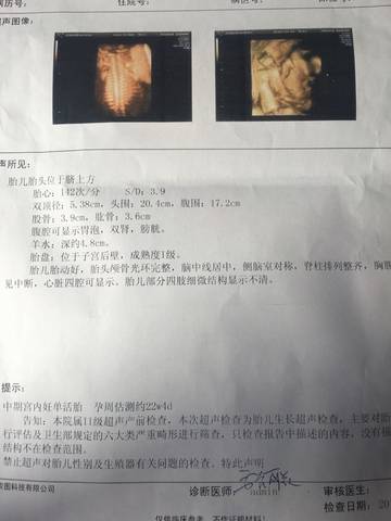 journal_insert_pic_592149800