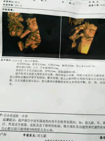 journal_insert_pic_594820017