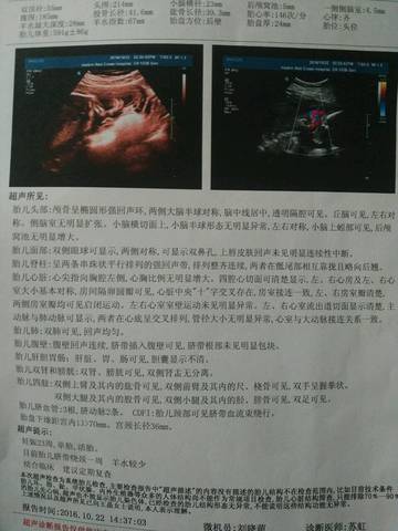 journal_insert_pic_595050013