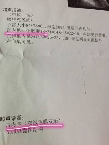 journal_insert_pic_595841214