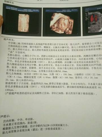 journal_insert_pic_596230083