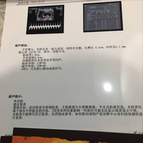 journal_insert_pic_596383039