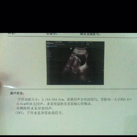 journal_insert_pic_597007494