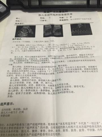 journal_insert_pic_596933348
