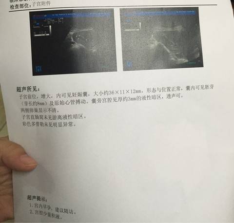 journal_insert_pic_597563573