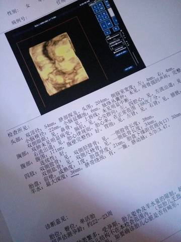 journal_insert_pic_598758598