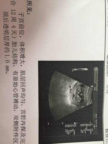 journal_insert_pic_598649086