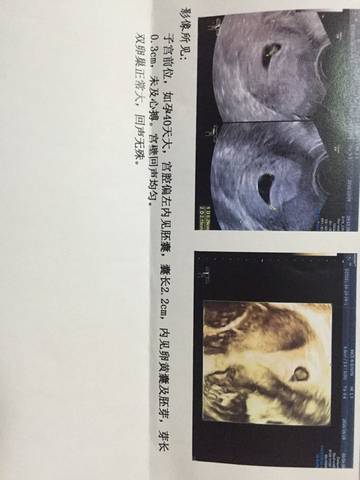 journal_insert_pic_599452104