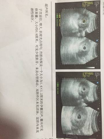journal_insert_pic_599452097