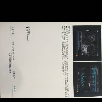 journal_insert_pic_601053492