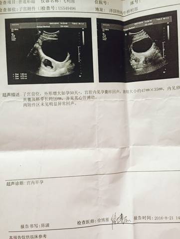 journal_insert_pic_601225740