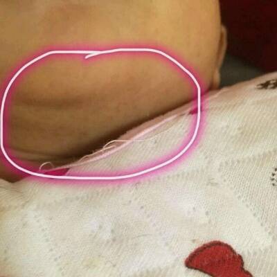 问答 婴儿期0-1岁 树友9gn3aevt26天2016-11-01         推荐回答