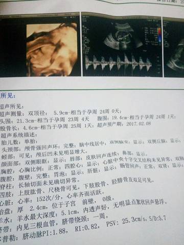 journal_insert_pic_601903436