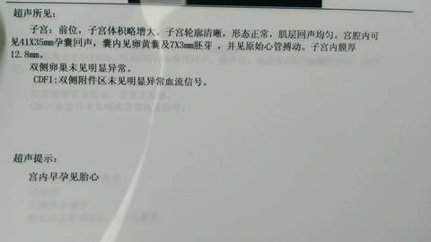 journal_insert_pic_602772143