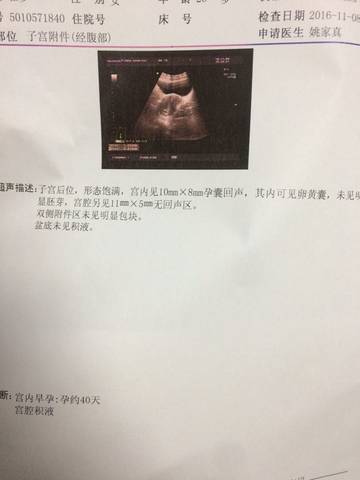 journal_insert_pic_605556341