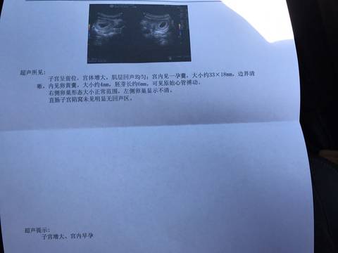 journal_insert_pic_606788207