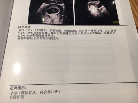 journal_insert_pic_609496783